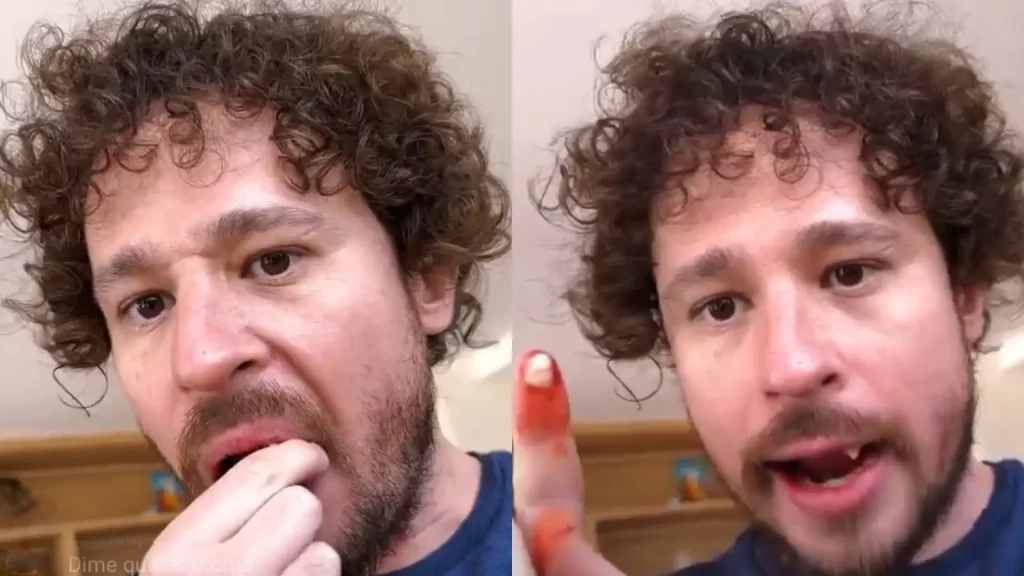 Luisito Comunica explica porqué “se le cayeron los dientes”