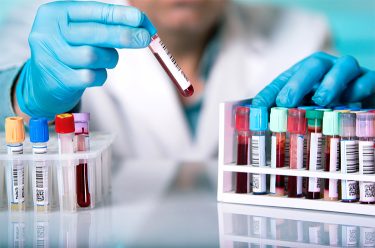 Científicos desarrollan cómo detectar varias enfermedades con una gota de sangre y luz infrarroja